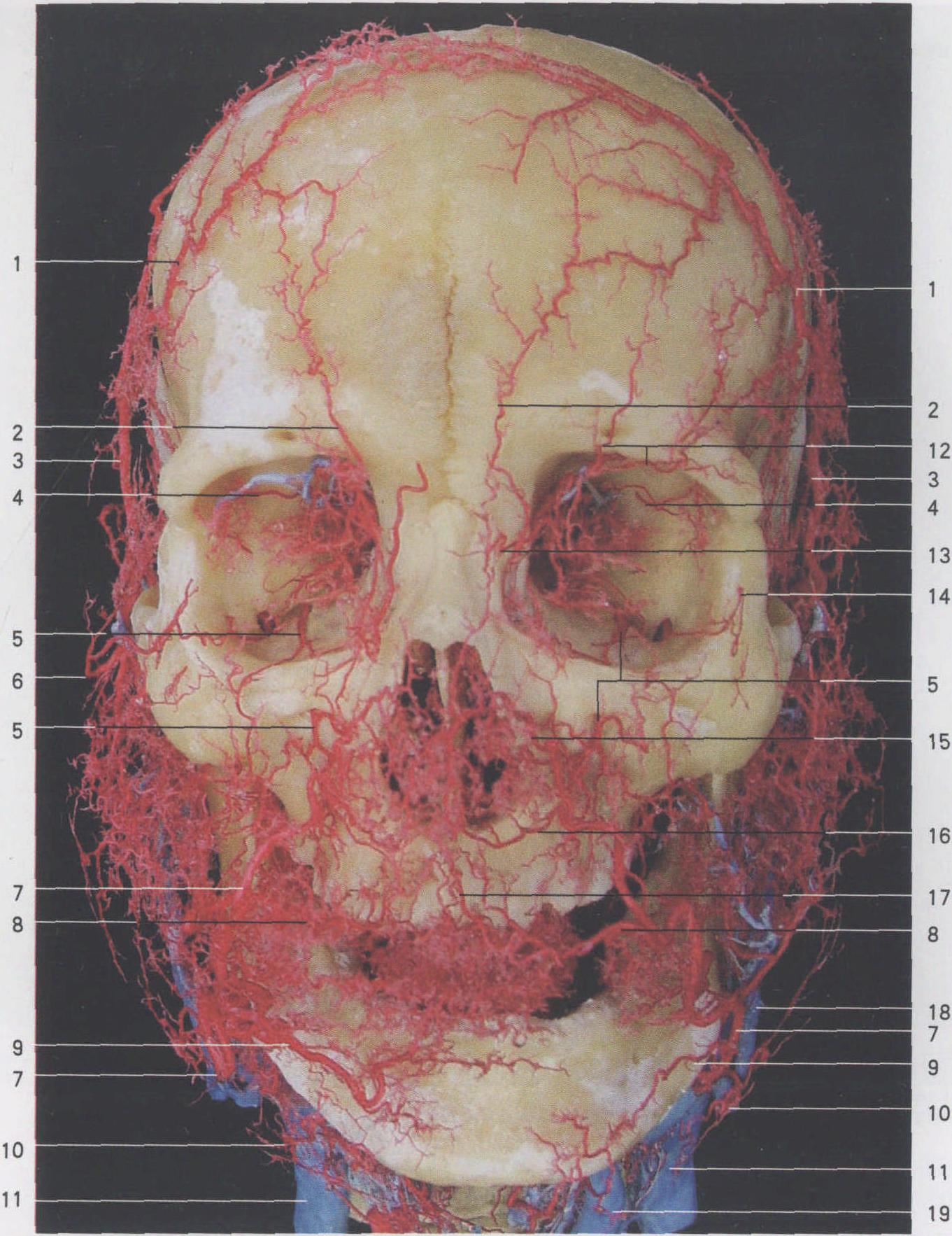 Ⅲ-6 头面部动脉(前面观) (铸型标本)